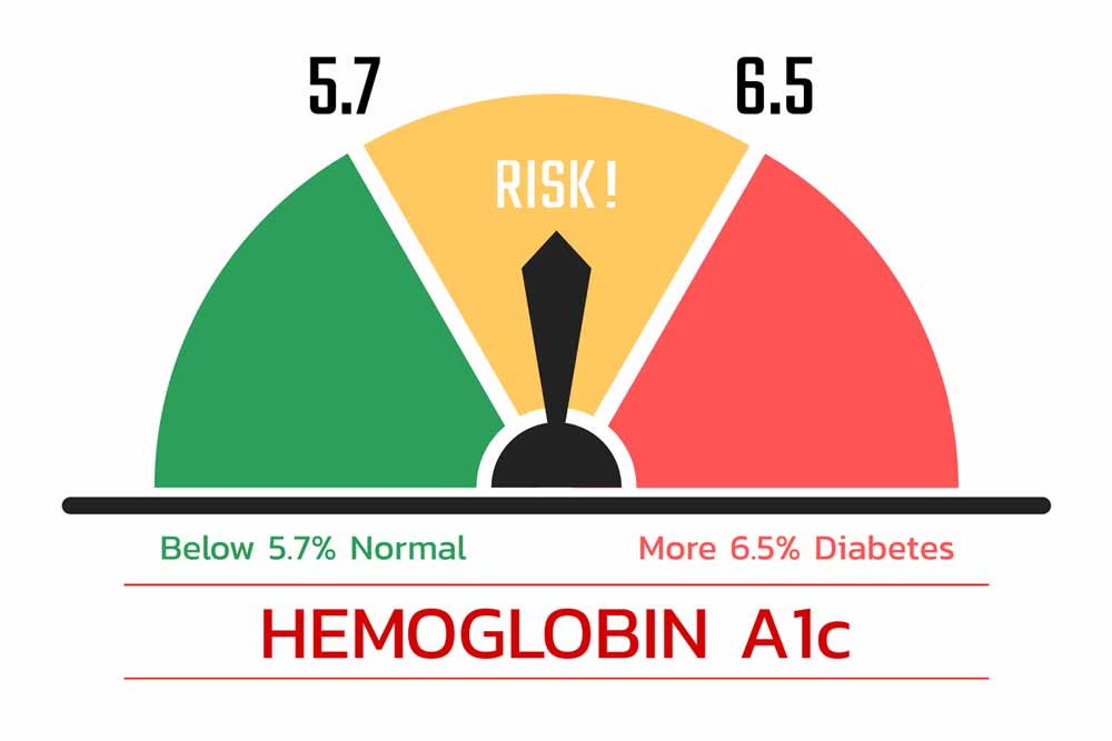 HbA1c Test Chart Hemoglobin A1c Check HbA1c Normal Range Levels Meaning Full Form