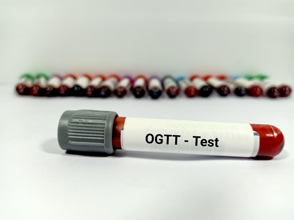 Oral Glucose Tolerance Test OGTT Uses And Preparation