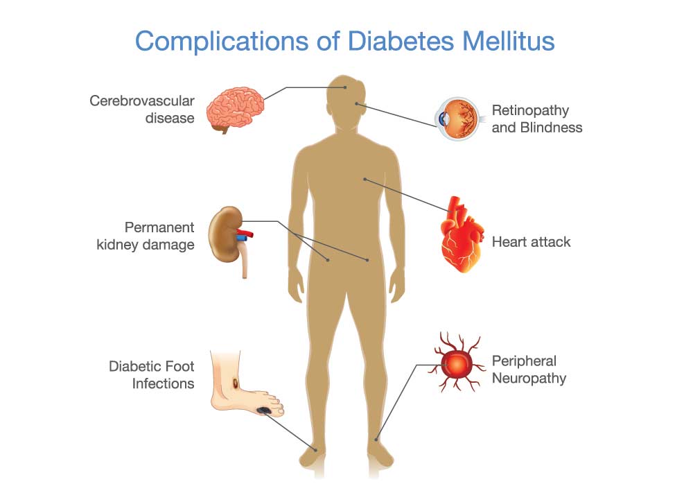 Complications Of Type 2 Diabetes Mellitus Check Now